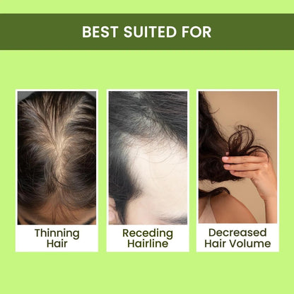 Rosemary Water Hair Spray – Natural Hair Regrowth